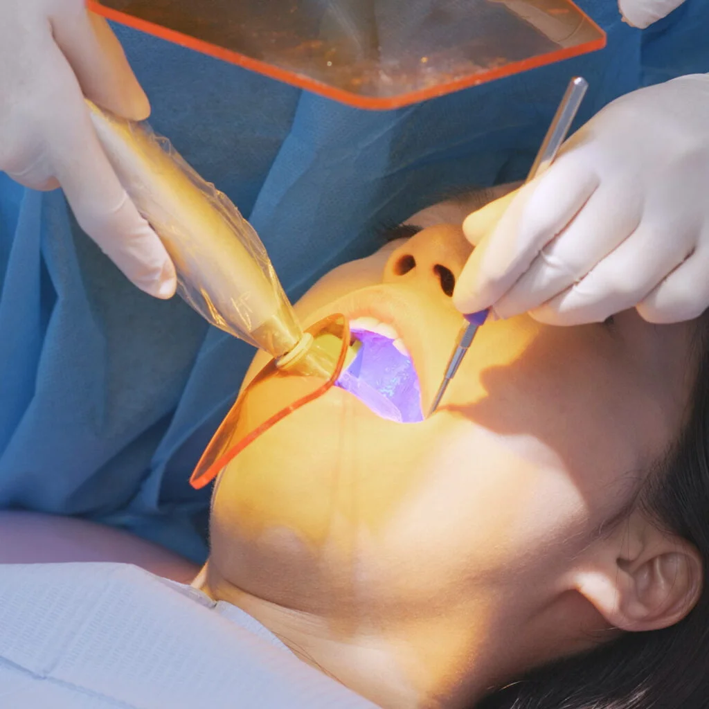 Root Canal Treatment 1 rot canal