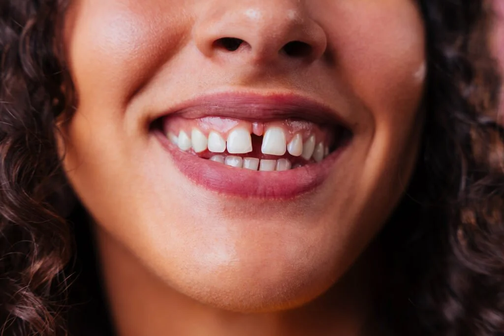 Braces 6 creative studio portrait of beautiful hispanic wom 2023 11 27 05 20 14 utc 1 1024x683 1