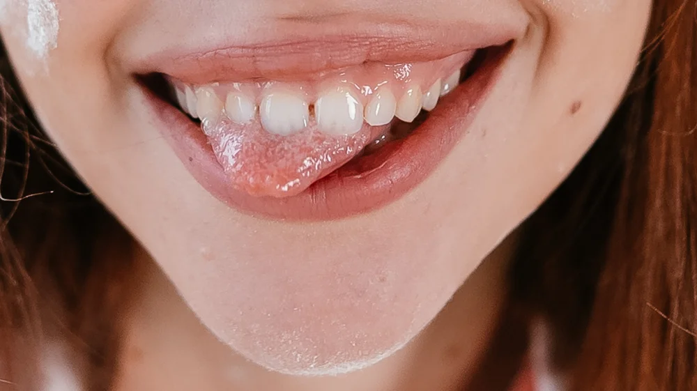 Minor Oral Surgery 6 close up of beautiful female smile with tongue out 2023 11 27 05 31 27 utc