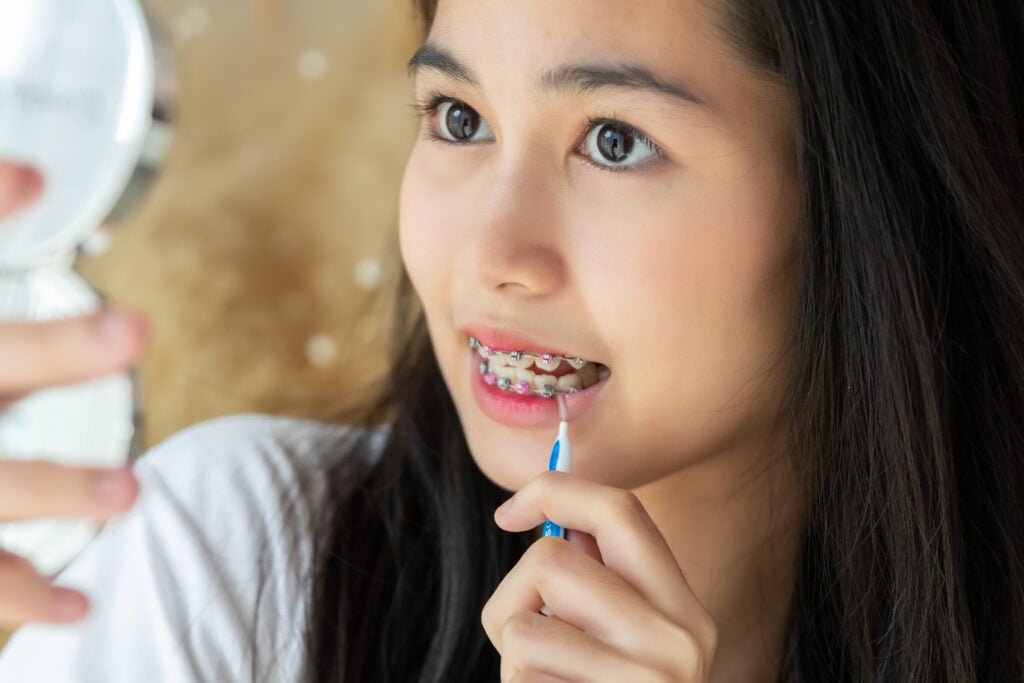 girl using brush cleaning braces treatment health 2024 02 02 17 19 40 utc