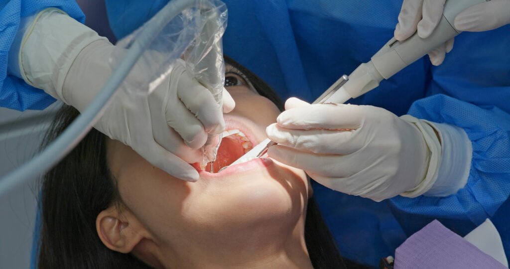 woman undergo dental scaling treatment 2023 11 27 05 34 51 utc