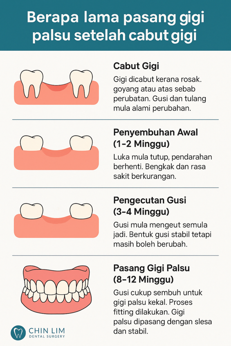 Berapa Lama Pasang Gigi Palsu Selepas Cabut