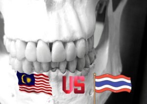 Dental implant cost Malaysia vs Thailand.