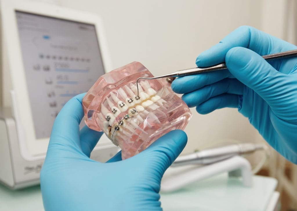 Dentist holding dental model inspecting brace fitting. 