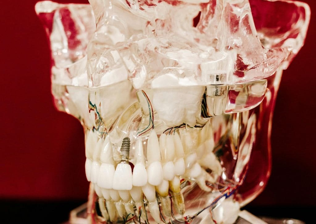 Dental implant costs in Malaysia compared to Thailand. Pros vs Cons