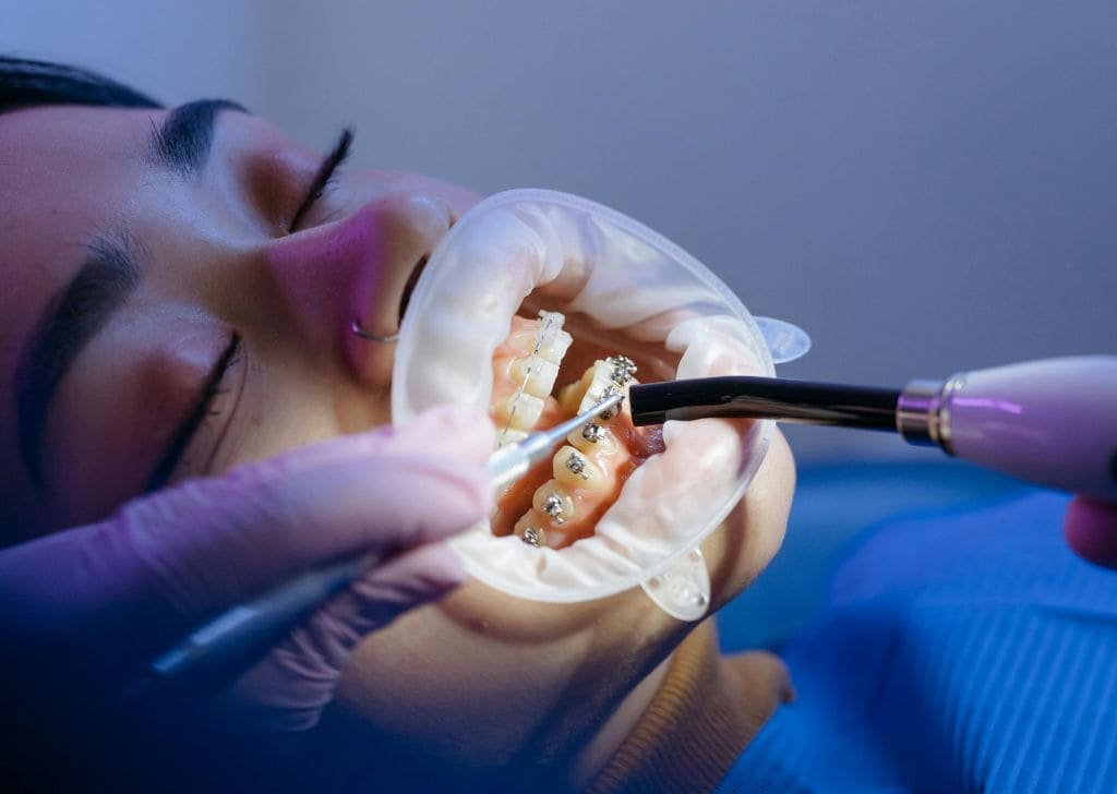 Patient in dental treatment to soothe braces pain.
