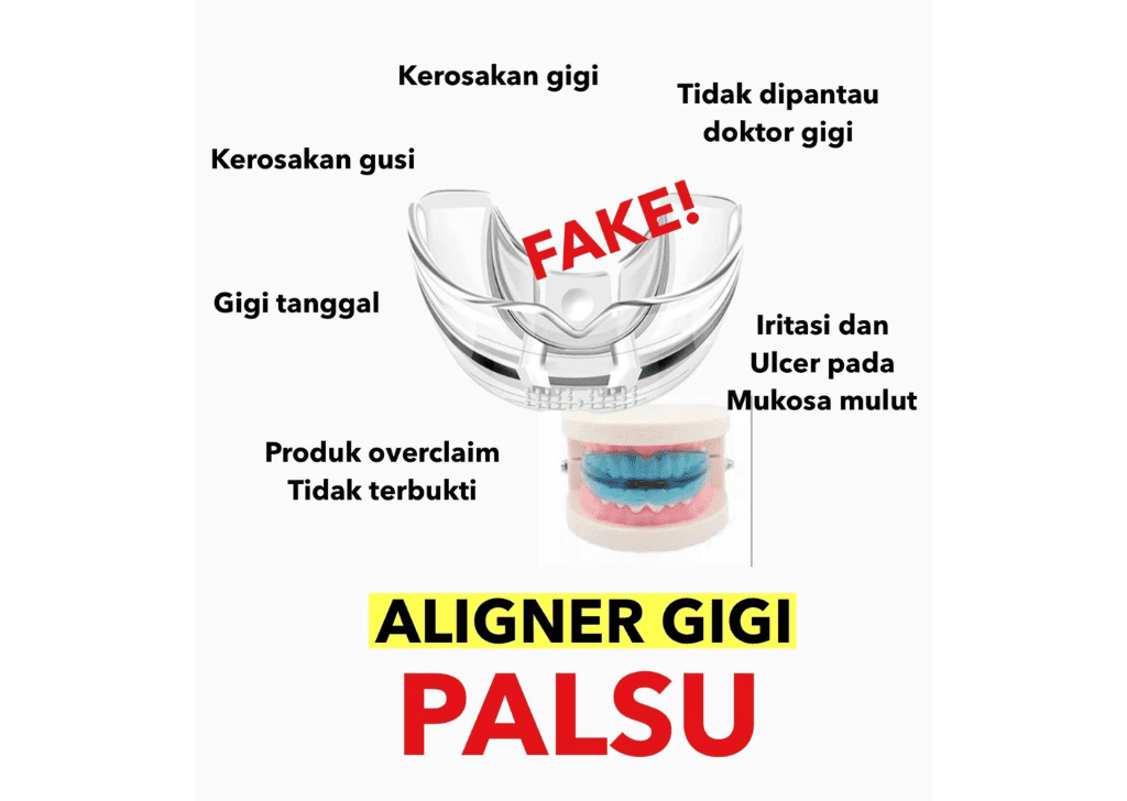 Kenapa Aligner Gigi Murah Boleh Menyebabkan Gigi Goyang?