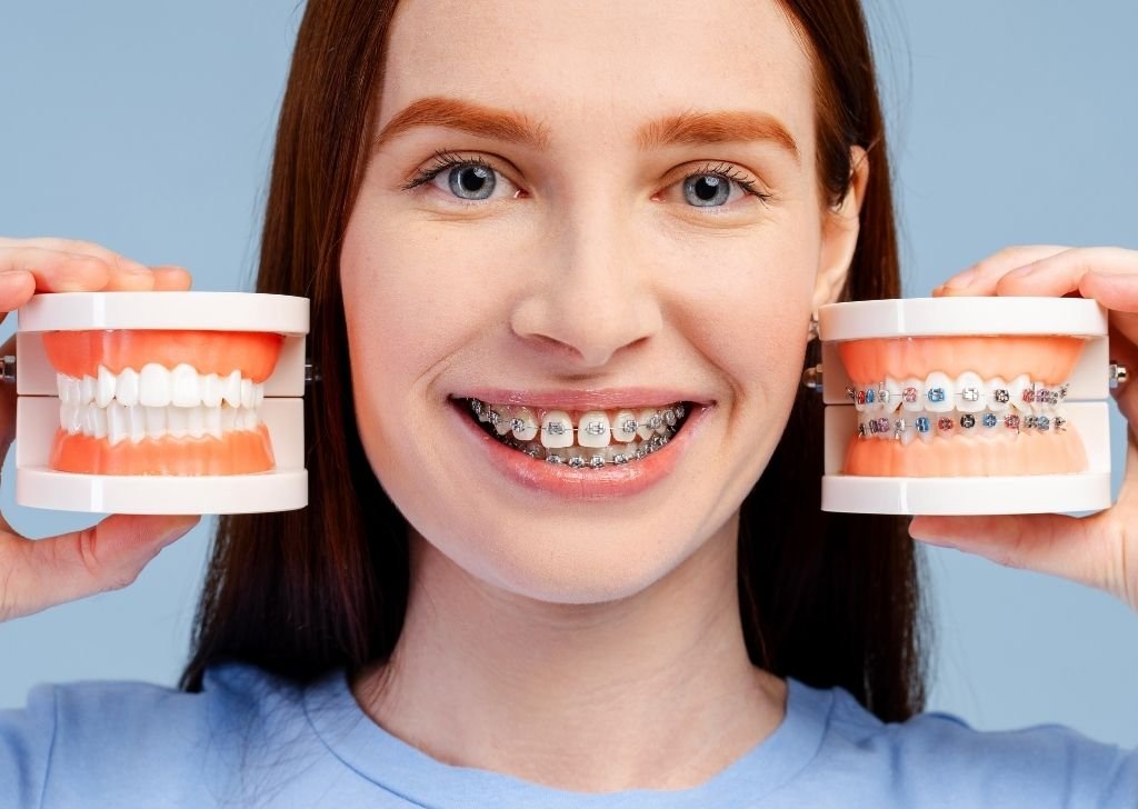 So, Are Colored Braces More Expensive in Malaysia?