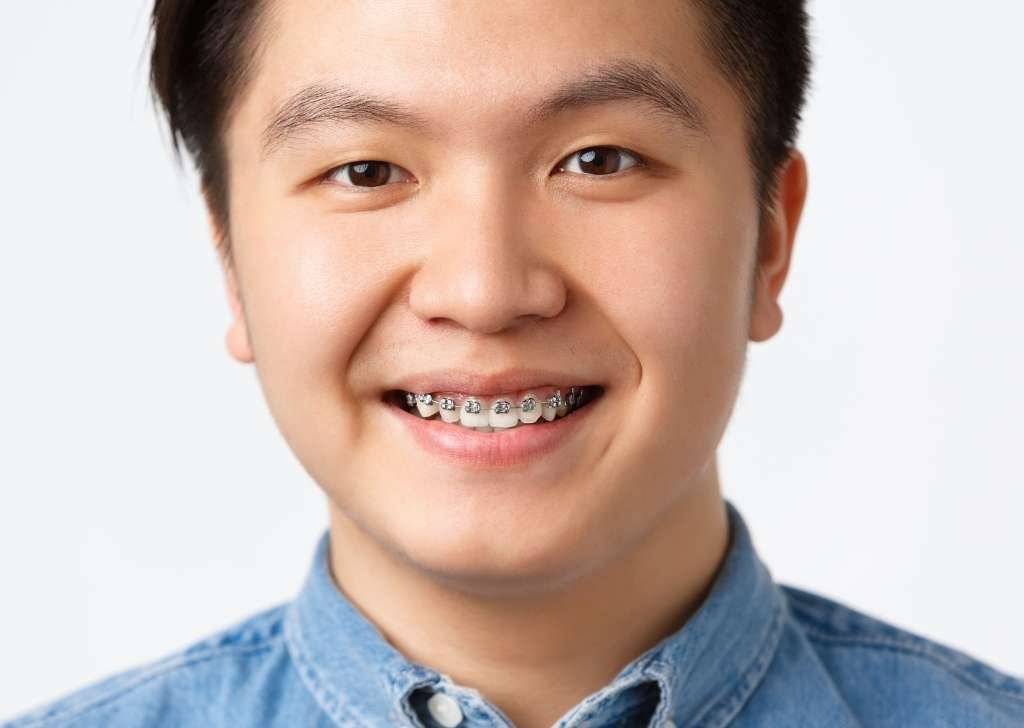 should you get your wisdom teeth removed before or after braces? The answer depends on your oral health, jaw structure, and long-term goals.