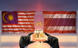 Harga Implan Gigi: Malaysia vs Thailand