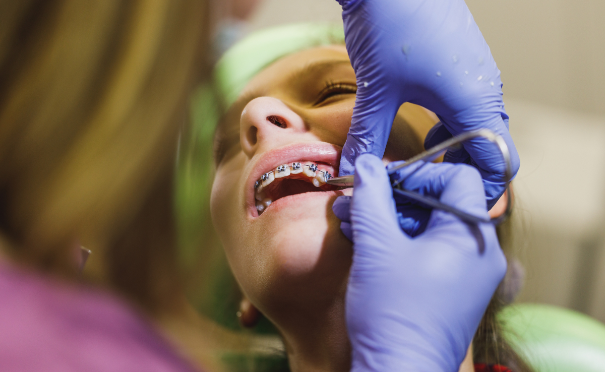 Doktor memasang braces pada pesakit